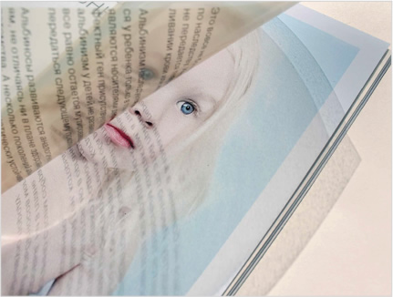 Буклет «Альбиносы».