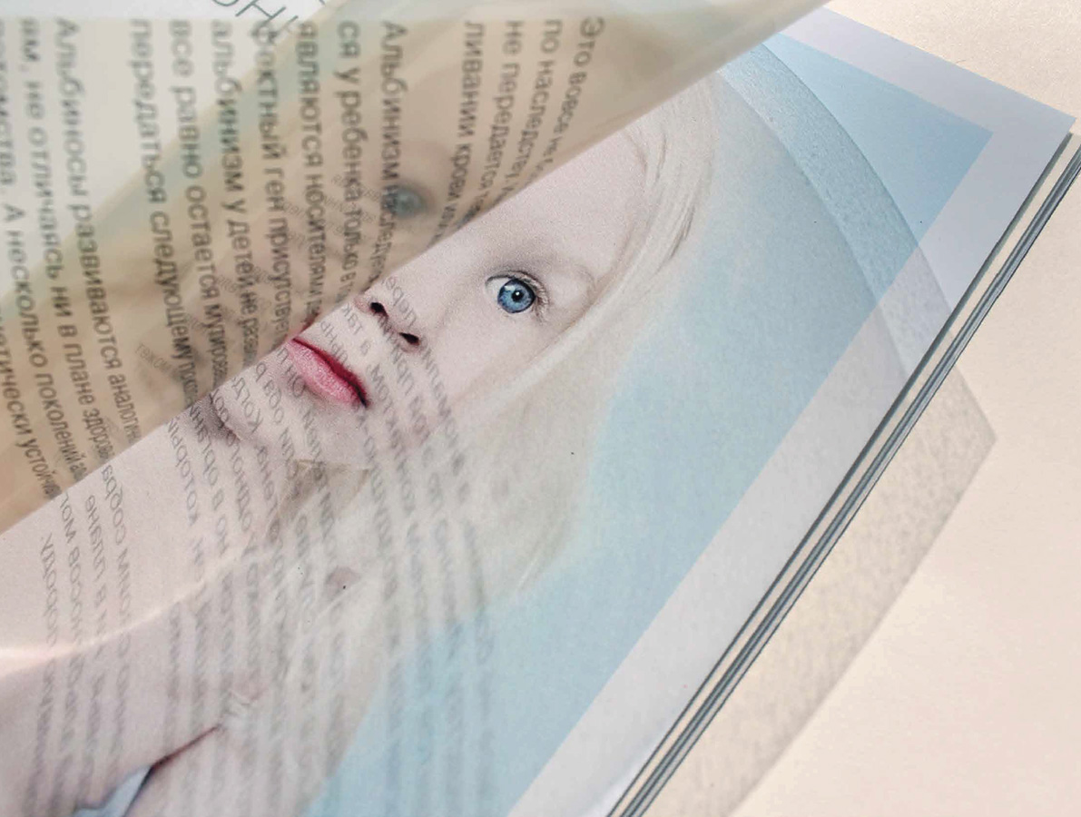 Буклет «Альбиносы».