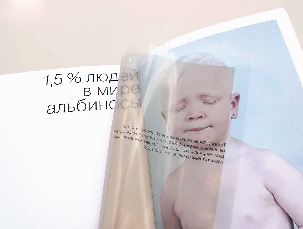 Буклет «Альбиносы».